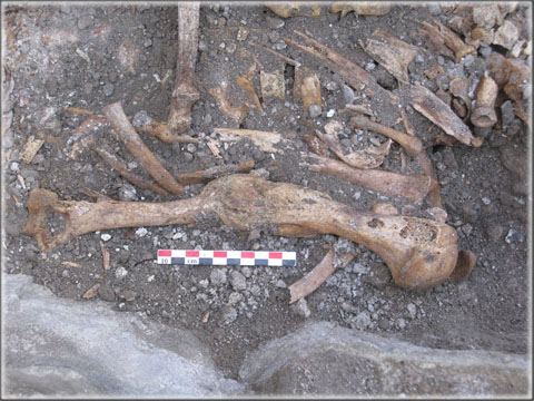 Fracture non réduite d’un humérus gauche sur un des squelettes découvert lors des fouilles préventives de la place de la République.